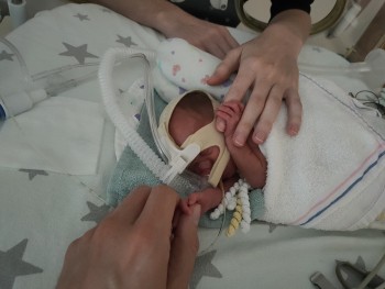 Jordi - Romee op NICU