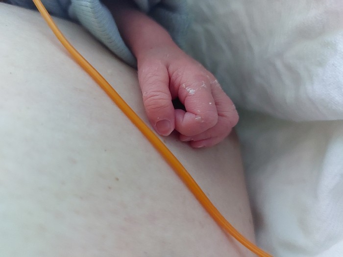 NICU